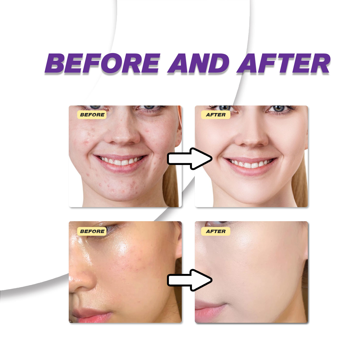 Mild Azelaic Acid Cream Improv - огляд і ціна Azelaic Acid Serum
