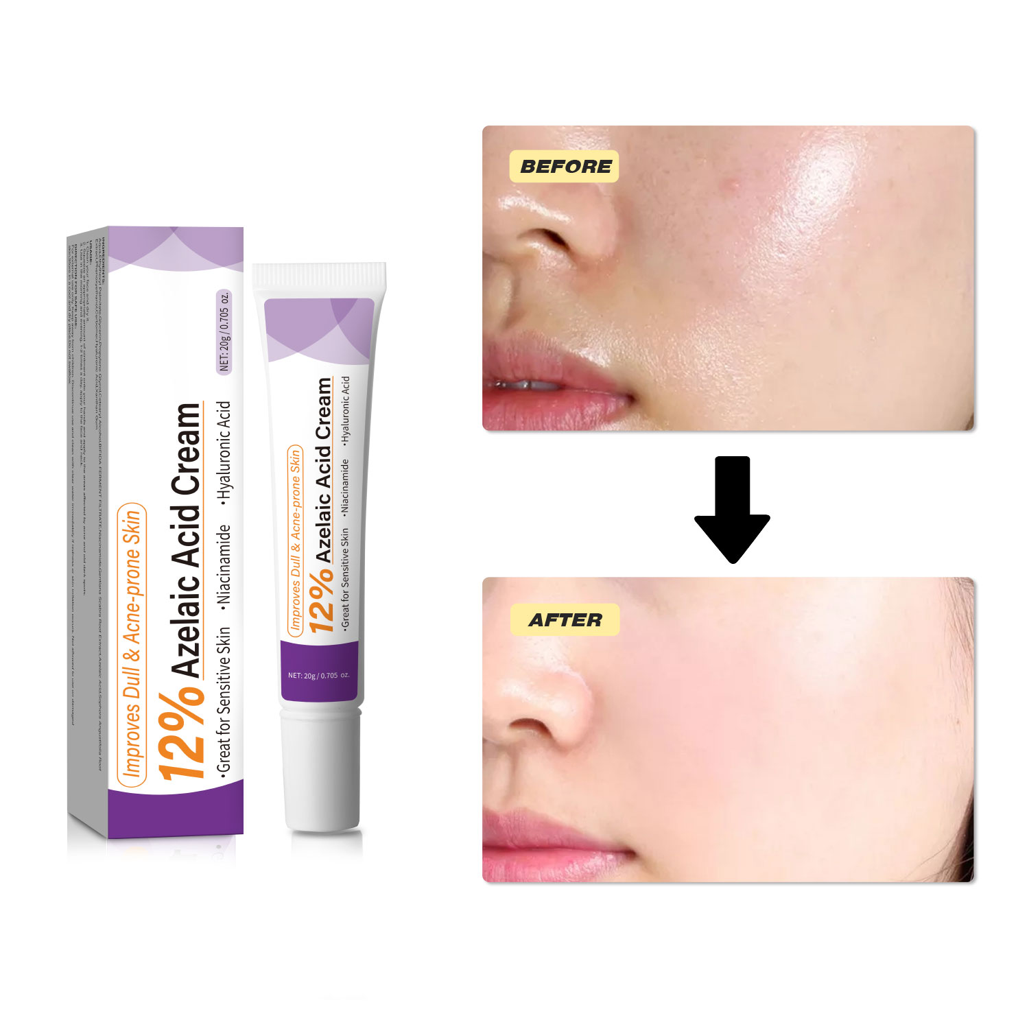 Mild Azelaic Acid Cream Improv - огляд і ціна Azelaic Acid Serum