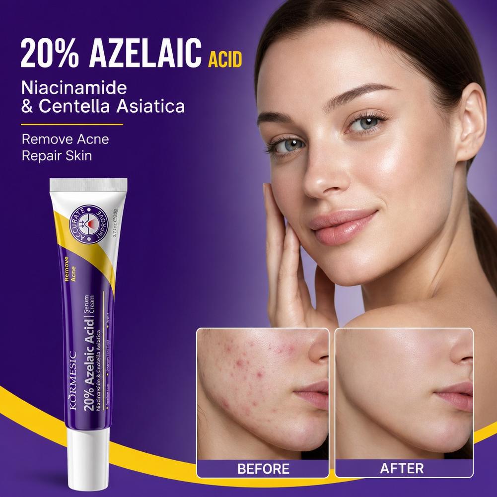 20% Azelaic Acid essence Deep  - огляд і ціна Azelaic Acid Serum