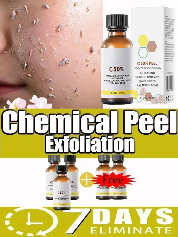 3nd Peeling Oil for Dark Skin  - огляд і ціна Azelaic Acid Serum